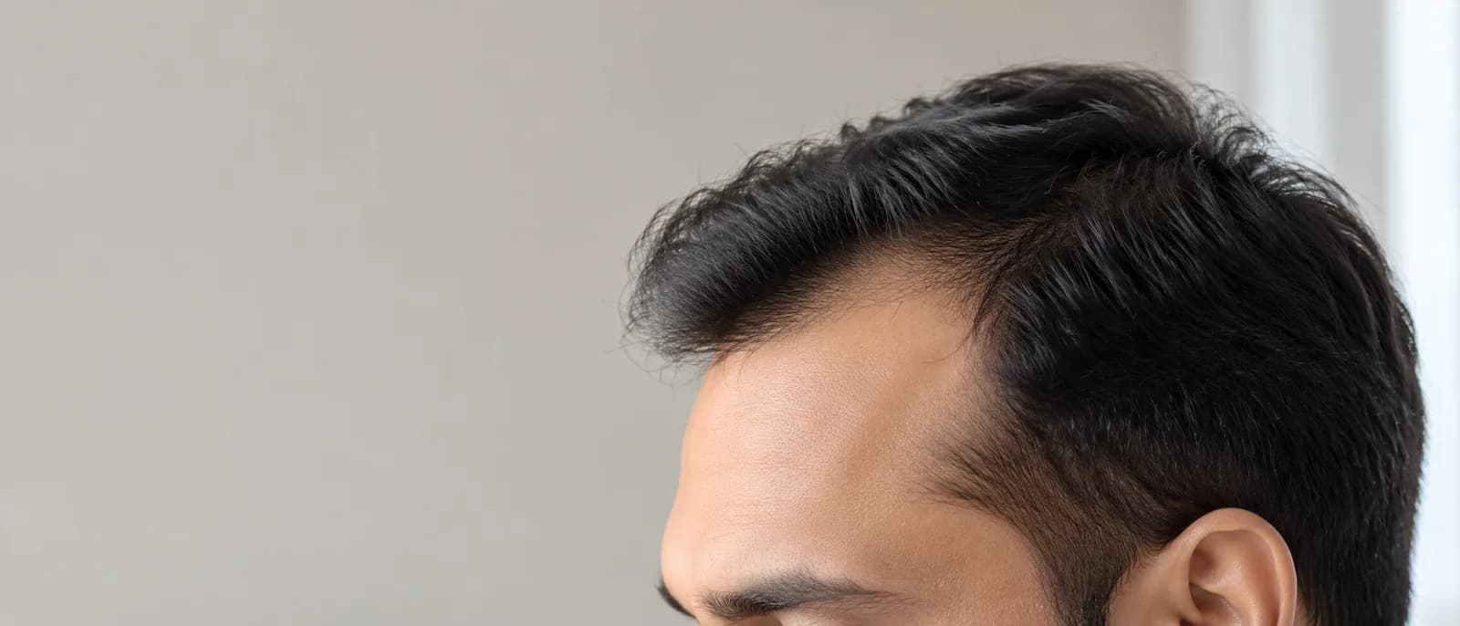 Side view of a hairline slightly receding at the temple