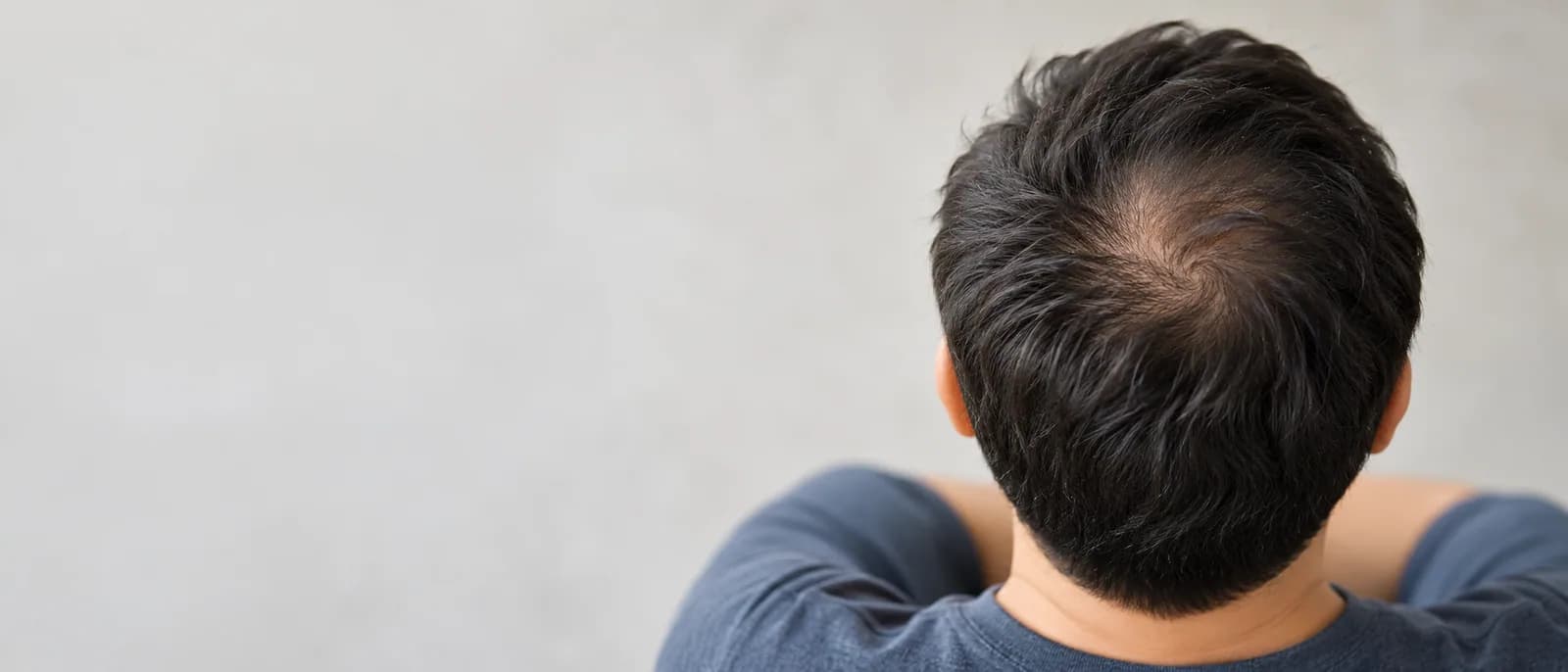 Looking down on slightly thinner hair at the crown