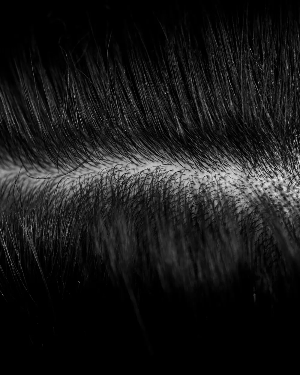 Black-and-white macro photograph of a scalp parting showing individual hair roots