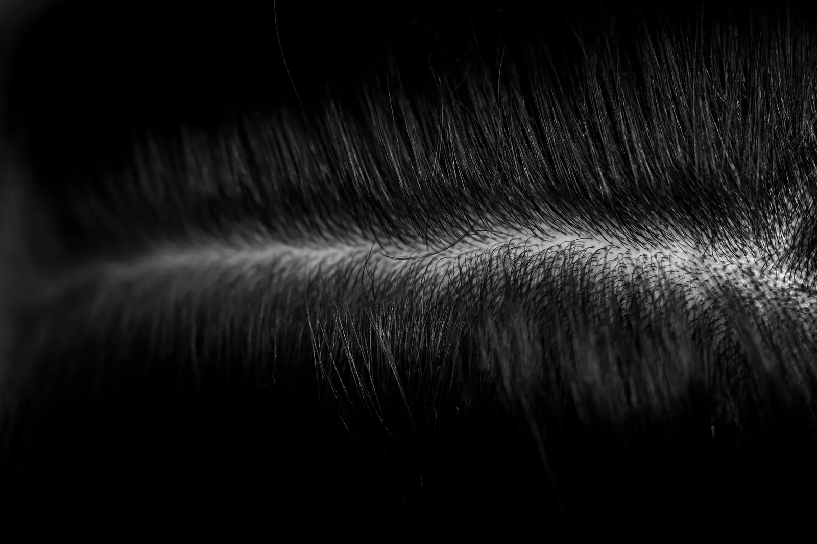 Black-and-white macro photograph of a scalp parting showing individual hair roots